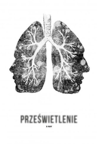 Przeswietlenie